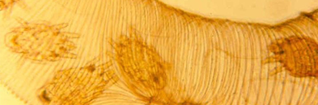 Figure 10. Five tracheal mites visible in a dissected honey bee trachea (140× magnification).