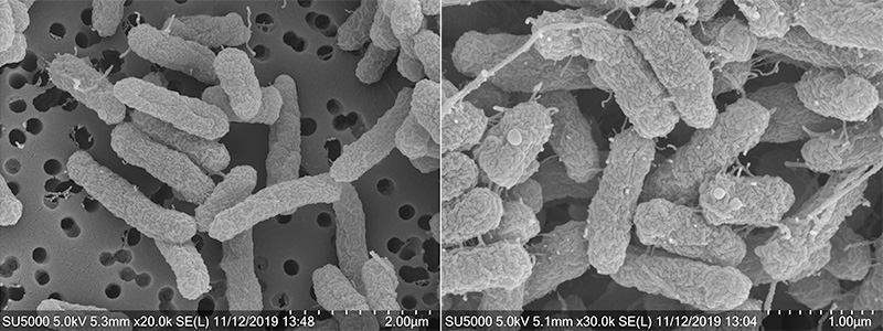bacteria before and after norovirus introduction