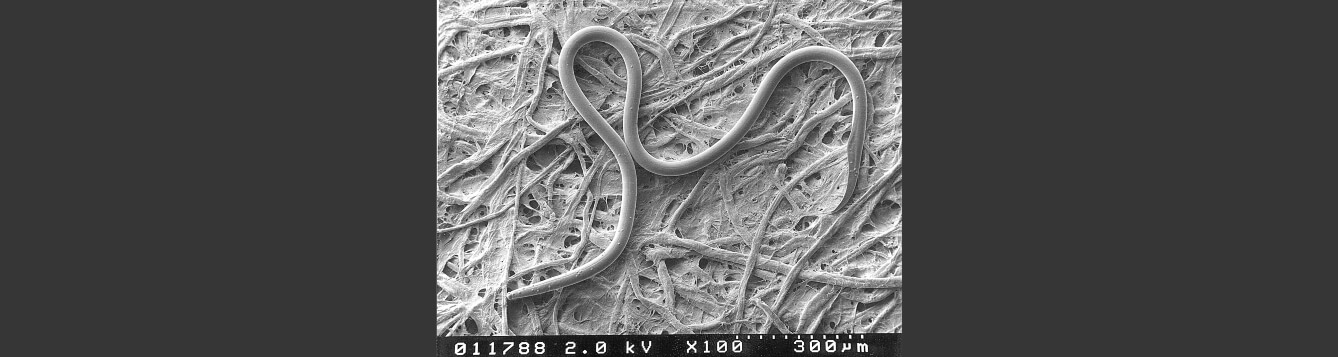Scanning electron micrograph of a sting nematode male