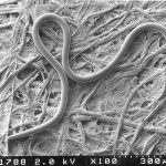 Scanning electron micrograph of a sting nematode male. [CREDIT: Tyler Jones, UF/IFAS]