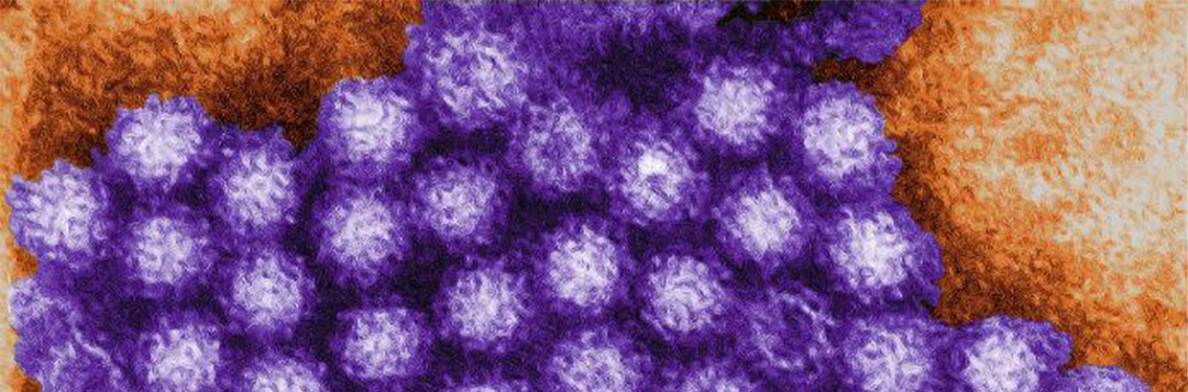Figure 1. Transmission electron micrograph of norovirus particles Credit: CDC/ Charles D. Humphrey