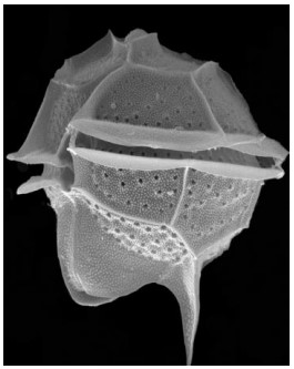 Black and white photo of the dinoflagellate Pyrodinium bahamense 
