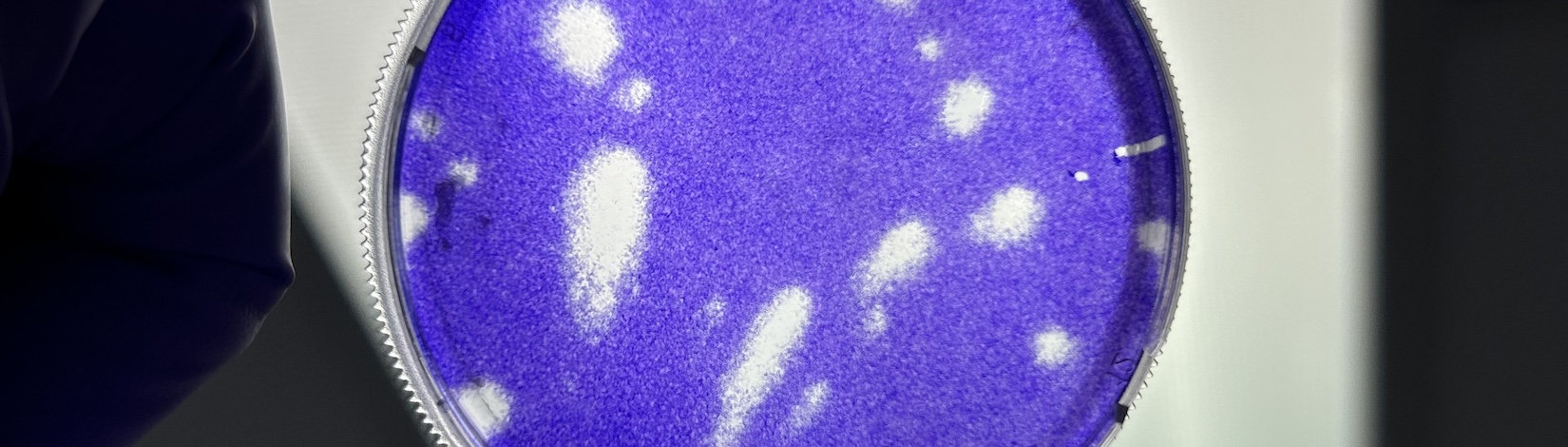 Part of a purple circle with white streaks inside, oyster | Food Science and Human Nutrition UF/IFAS