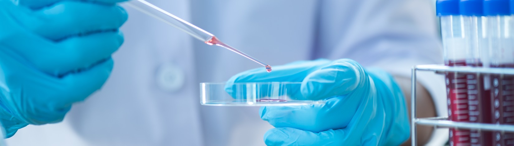 Hands wearing blue gloves holding a pipette and a petri dish in a laboratory setting.