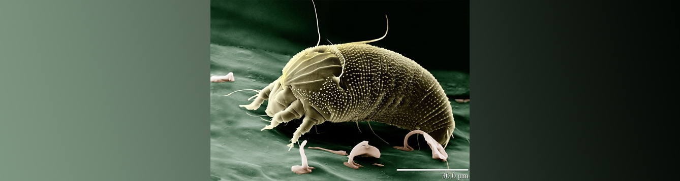 rust mite seen under microscopic magnification