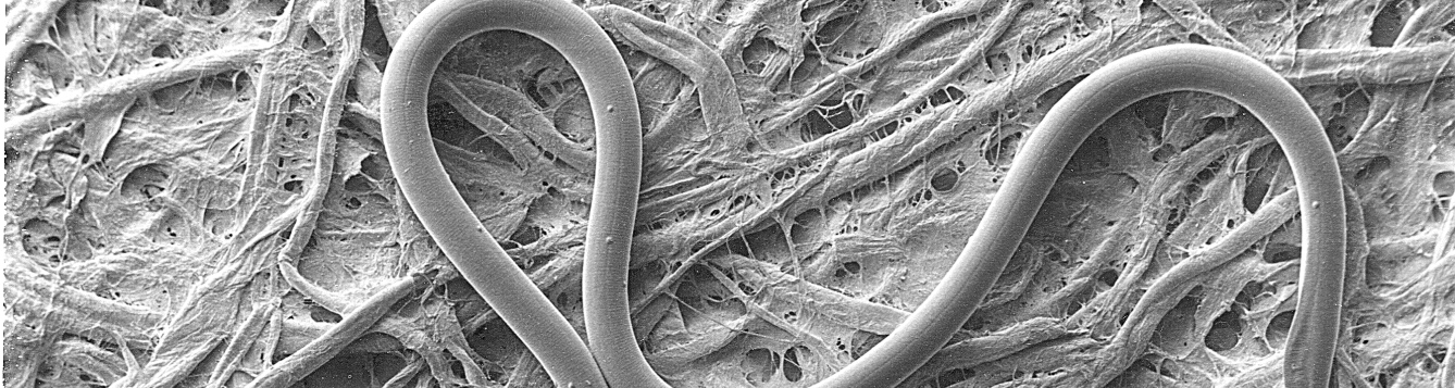 Scanning electron micrograph of a sting nematode male.