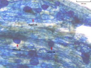 An image from a microscope showing the hyphae and vesicles of mycorrhizal fungi.